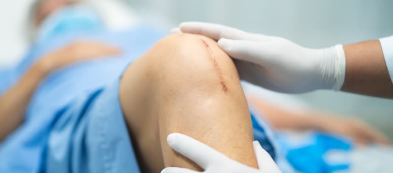 Senior person representing knee replacement